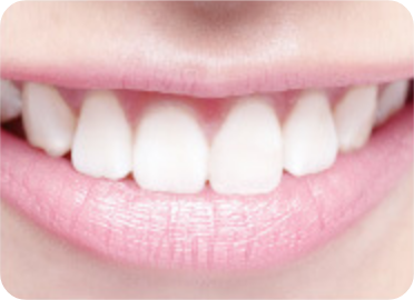 スーパーポリリン酸ホワイトニング